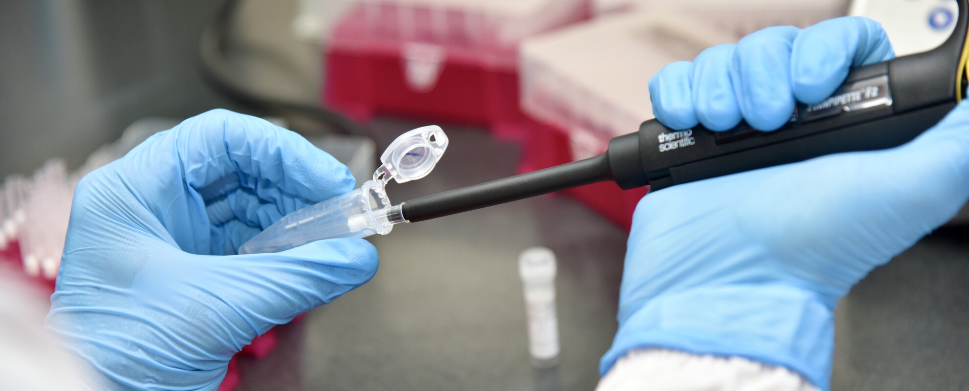 Pipetting of reagents (Photo Credit: ILRI/Saleef Nyambo)